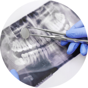 centro de endodoncia